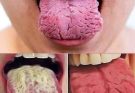 NEWS:These are the consequences of sleeping with the… See more